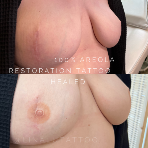 Areola Restoration Tattoo Vancouver DAELA Lina