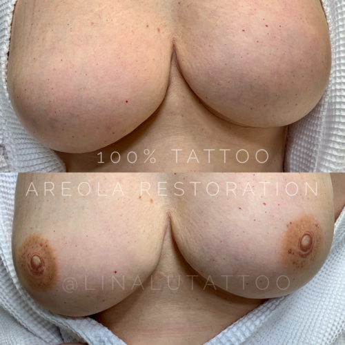 Areola Restoration Tattoo Vancouver DAELA Lina
