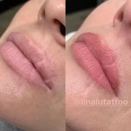 Scars: Amazing Ways to Cover Up a Scar with a Tattoo!